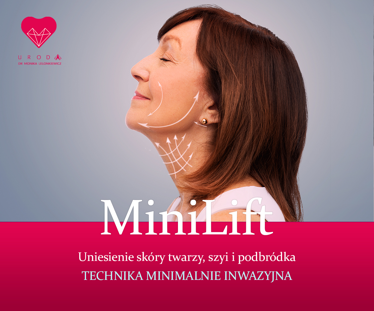 Czym jest MiniLift?